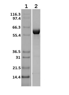 Lane 1: Molecular weight marker (Mark12 Unstained Standard)<br />Lane 2: SMTGR